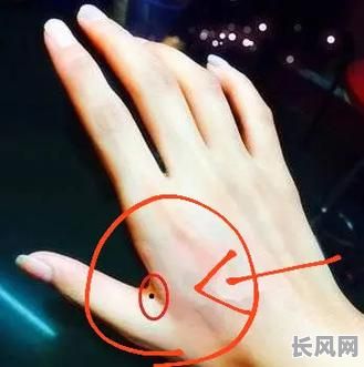 掌心痣究竟预示着怎样的命格女性?