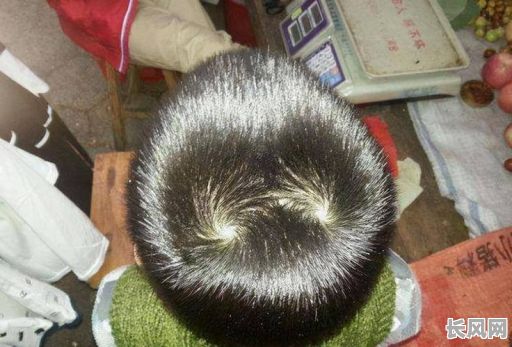 头顶有凹陷的命格男孩,这预示着怎样的命运?他的未来会怎样?