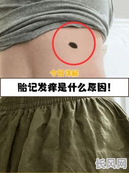 身体胎记的位置究竟预示着怎样的命运?